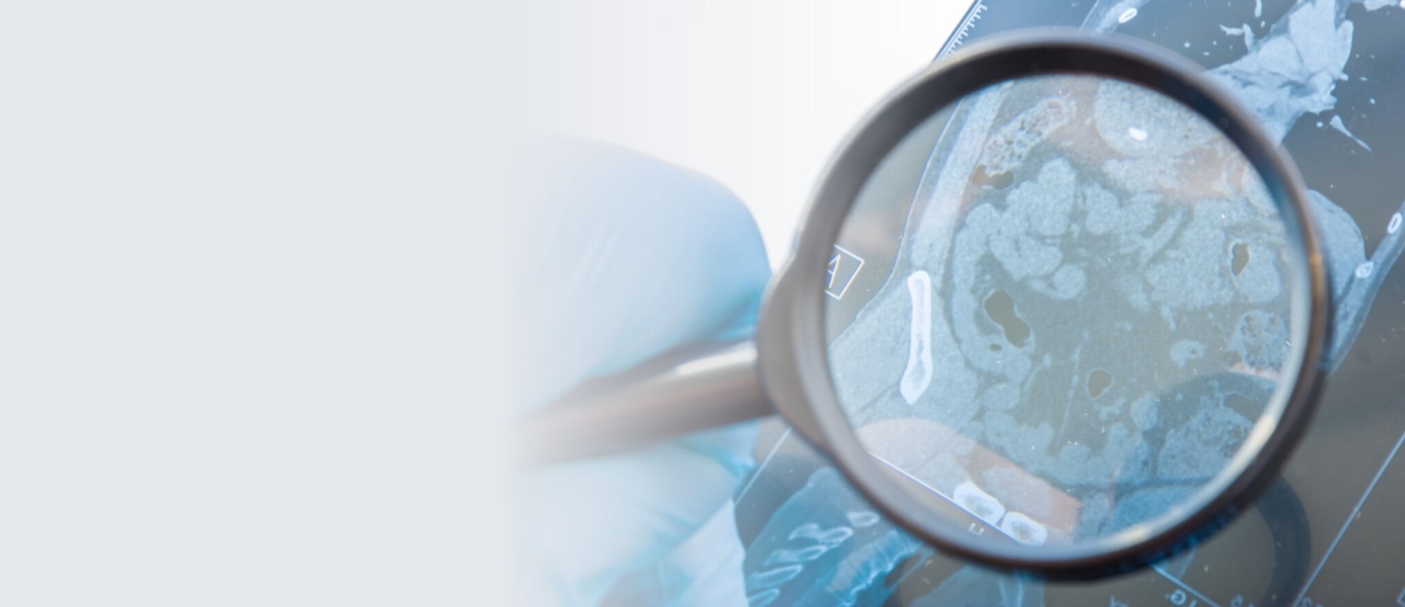 Solutions_maladies rares